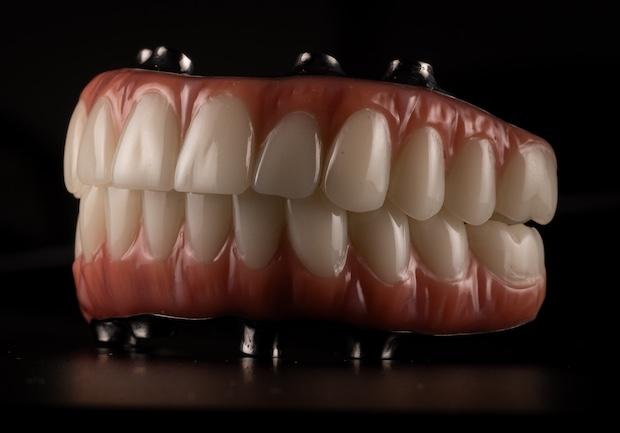 Full Mouth Reconstruction